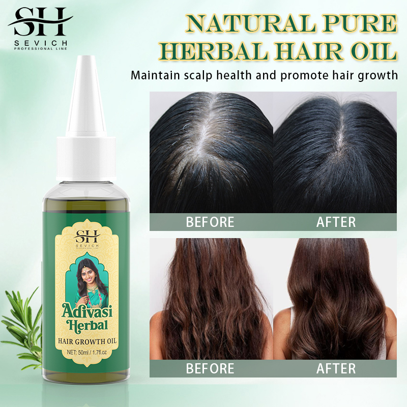アユルヴェーダ-有機育毛オイル,脱毛防止,迅速な再生,ヘアケ - Coconut Oil Refined のレビューと価格